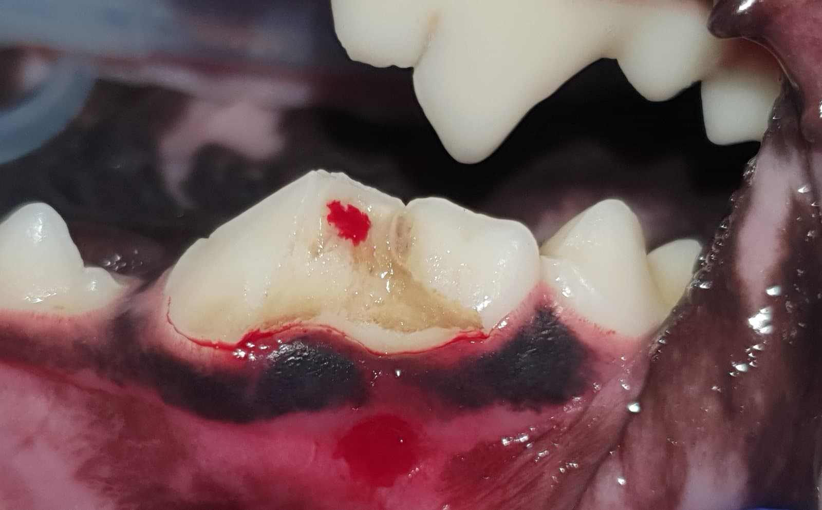 traumatologia stomatologiczna — uraz zęba
