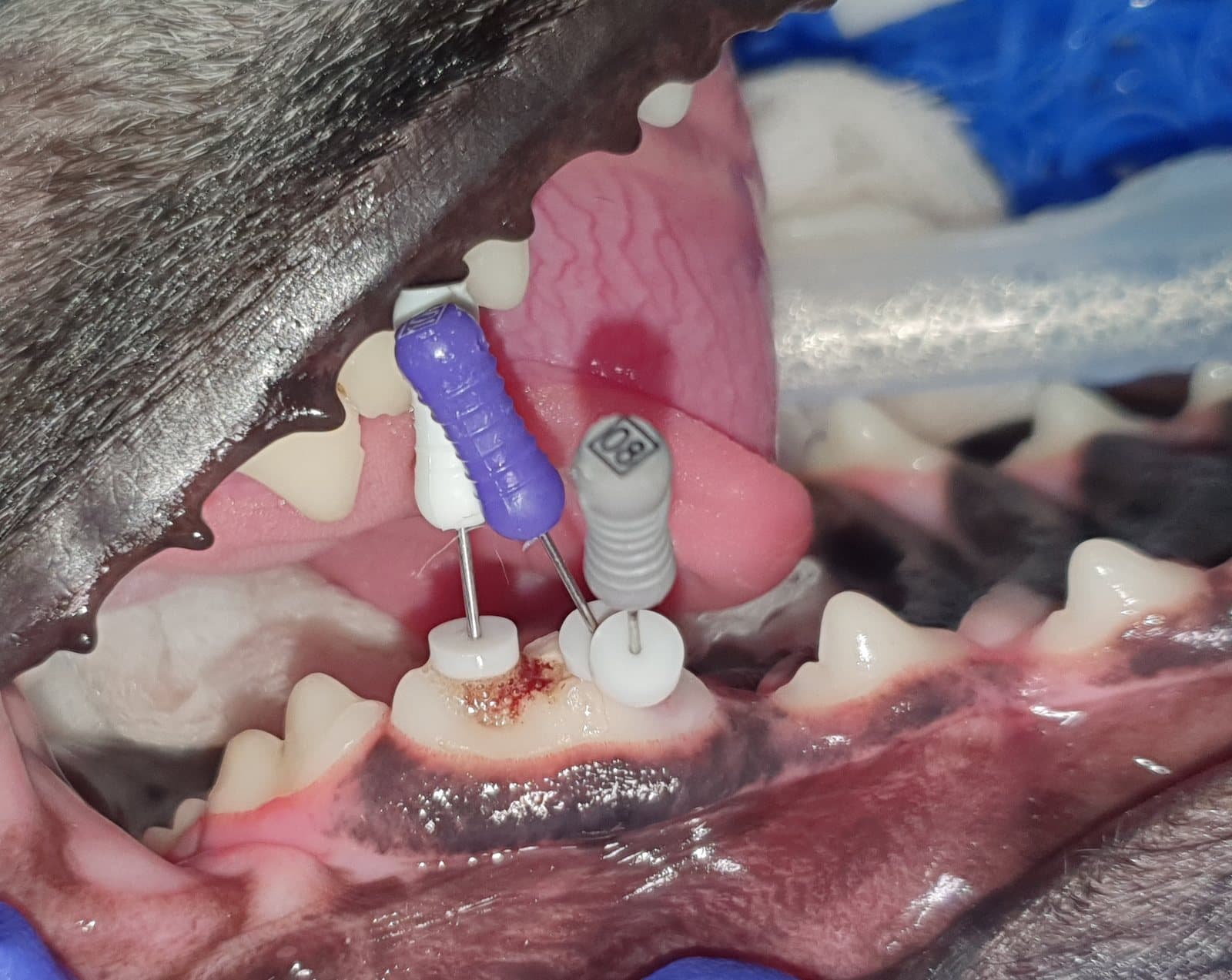 leczenie endodontyczne